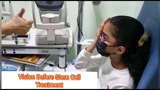 Stem Cell Treatment for Stargardts or Macular Dystrophy [upl. by Gerhan]