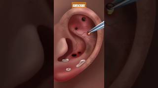 Asmr ear cleaning2 asmr asmrtriggers relaxingasmar satisfying shorts asmrvideos asmrsounds [upl. by Rolo]