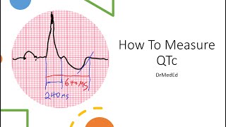 How to measure QTc CORRECTLY [upl. by Ocana959]