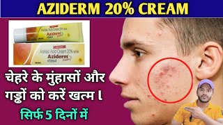 Aziderm 20 cream use dose benefits and side effects full review in hindi [upl. by Ludly]