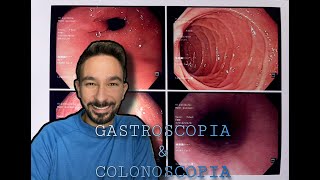 Endoscopia Colonoscopia y Gastroscopia ¡¡Mi experiencia [upl. by Relyhcs478]