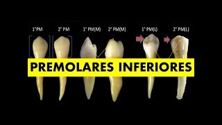 quotPREMOLARES INFERIORESquot por el Dr Henry Vicente [upl. by Ynavoeg]