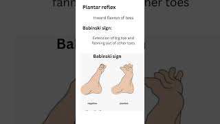 Babinski signUpper motor neuron lesionplantar reflex [upl. by Robbert]