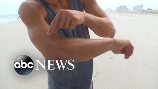 Surfers shark bite caught on camera off Florida coast [upl. by Vonnie]