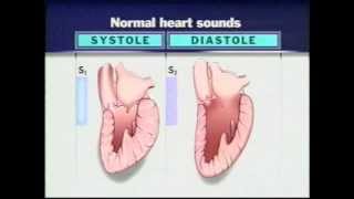 Auscultation of Heart Sounds Part1  Listening to Heart Sounds [upl. by Krusche]