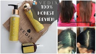 I tried VEDIX for 1 Month  100 Honest Non Sponsored VEDIX Review  Customised Hair Routine  Kavya [upl. by Irtemed]