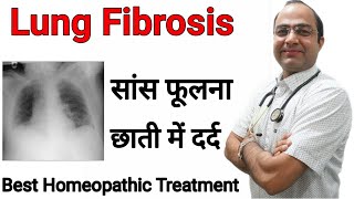 Lungs Fibrosis Pulmonary Fibrosis साँस फूलना ।छाती दर्द [upl. by Arrekahs617]