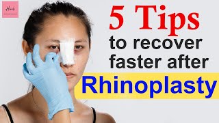 🔴PostOp Rhinoplasty  Tips to Recover Faster After Rhinoplasty Surgery  Pain After Rhinoplasty [upl. by Asert]