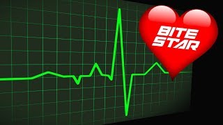 ❤️ HEARTBEAT Sound Effect 🩺 Slow to Fast Flatline and Heart Attack Sounds Bite Star [upl. by Bordiuk]