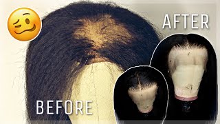 HOW TO REPLACE AN OLDBALDING FRONTAL ON A CUSTOM WIG [upl. by Kcyred470]