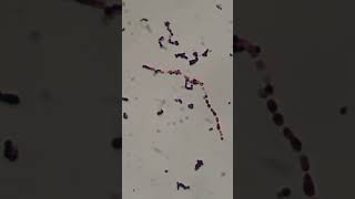 Streptococcus agalactiae in Gram staining of Culture Microscopy [upl. by Pilloff178]