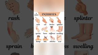 Types of Injuries  Injury Names [upl. by Lacombe123]