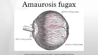 Amaurosis fugax [upl. by Pepe452]