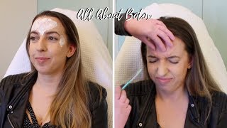 All About Botox 💉 Crows Feet Forehead 11 Before amp After Photos Does It Work Cost Review [upl. by Aurore678]