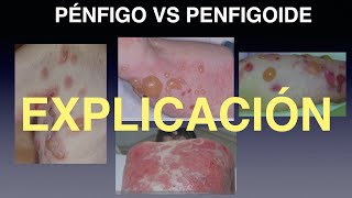 Pénfigo vs Penfigoide Comparativa [upl. by Adeuga]