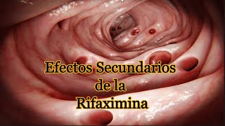 Efectos Secundarios de la Rifaximina [upl. by Ferdy]