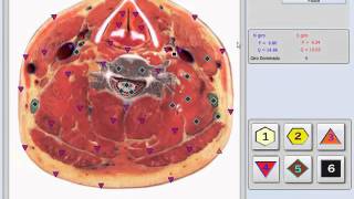 Bioplasm 10D NLS Modelo 2016 [upl. by Jamal954]