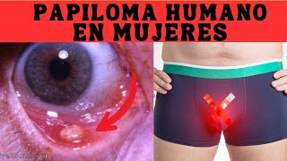 ✳ PAPILOMA HUMANO Sintomas Causas y Tratamientos [upl. by Marigolde]