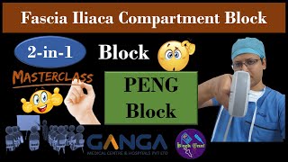 RA Masterclass Ultrasound Scanning Session  PENG Block  FICB  2in1 Block  DrTuhinM [upl. by Godric]