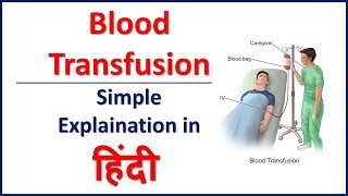 Blood Transfusion simple explaination in Hindi  Bhushan Science [upl. by Nohsav]