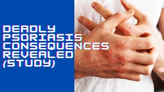 Deadly Psoriasis Consequences Revealed Study [upl. by Oidacra]