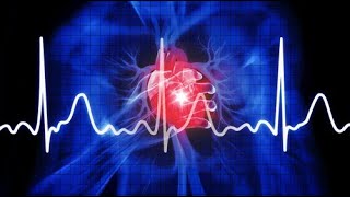 SVT AF VT VF Aritmiler EKG 2 [upl. by Garris]