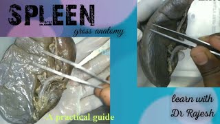 SPLEEN  Specimen demo [upl. by Eioj]