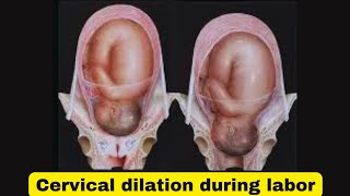 Cervical dilation how to check for laborhow to check if your cervix is dilated [upl. by Shandie]