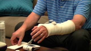 How to use your EXOGEN Ultrasound Bone Healing System with a Ported Cast [upl. by Sices]