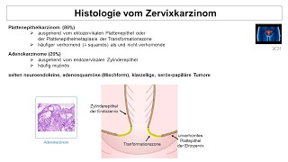 Histologie vom Zervixkarzinom  Strahlentherapie Prof Hilke Vorwerk [upl. by Gyatt]