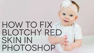 How to Fix Blotchy Red Skin in Photoshop [upl. by Eikram158]