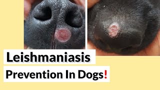 Be aware Of Leishmaniasis [upl. by Nayarb97]