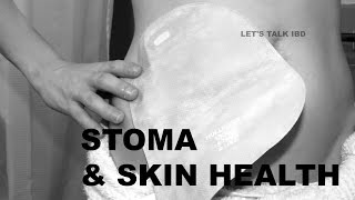 Stoma and Skin Health [upl. by Oruhtra]