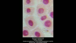 Mitosis  Cell Division different stages under Microscope biology neet agriculture genetics [upl. by Llerrehs766]