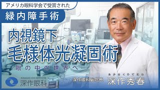 【手術解説】緑内障手術内視鏡下で毛様体光凝固術 [upl. by Derrick]