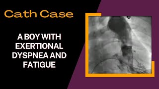 Cath Case Pulmonary Stenosis PS on ventriculography cardiology cath diagnosis [upl. by Razaele]