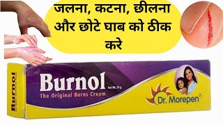 Burnol cream  Burnol cream use in Hindi  Burnol cream review in Hindi  shorts [upl. by Durer]