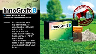 New Product Launch Introducing InnoGraft B with Clinical Case [upl. by Nosinned432]