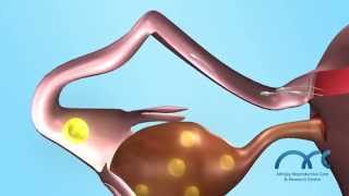 3D Human Natural Fertilization  Best fertility hospital in chennai India [upl. by Kask]