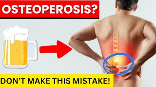 How to STOP osteoporosis and boost your bone health [upl. by Park107]