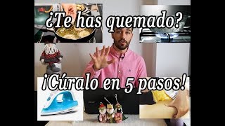 5 PASOS si te has QUEMADO con ACEITEAGUA HIRVIENDOLA PLANCHACERAETC [upl. by Gensmer]