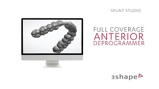 3Shape Splint Studio Full coverage Anterior deprogrammer [upl. by Harlan390]