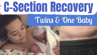 CSECTION RECOVERY TWINS amp BABY  CSection Recovery Tips  Postpartum Care  Mai Zimmy [upl. by Bussey]