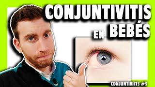 ▶️ La CONJUNTIVITIS en BEBÉS y en niños ¿Qué hacer  Capítulo 3 [upl. by Ariay449]