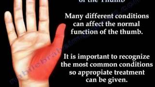 Common Conditions Of The Thumb  Everything You Need To Know  Dr Nabil Ebraheim [upl. by Launce312]