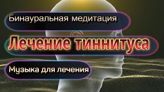 Лечение тиннитуса Самая мощная звуковая терапия тиннитуса Бинауральные ритмы Музыка для лечения [upl. by Willette]