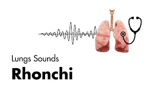 Rhonchi  Lung Sounds  Medzcool [upl. by Artep]