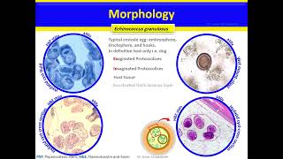 Echinococcus granulosus and Echinococcus multilocularis Cestodes [upl. by Dnalyaw]