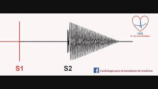 Soplo de la insuficiencia aórticaAortic Insufficiency murmur [upl. by Claude]