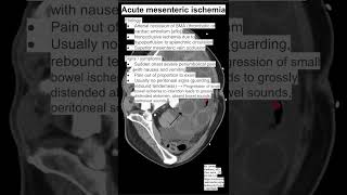 Acute mesenteric ischemia [upl. by Ikcir]